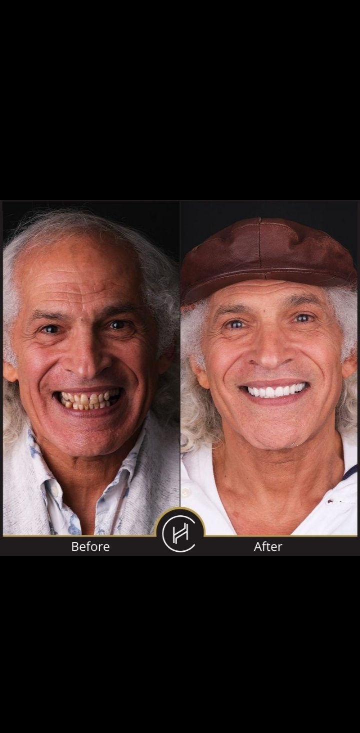 Before treatment